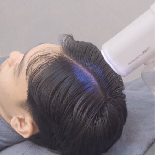 Inside The Better Face, where Hair Growth with Salmon Sperm PDRN is performed